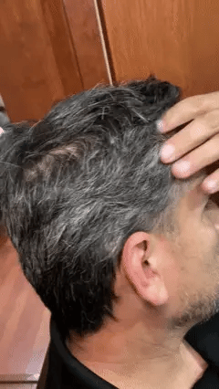 Shampoo Chao Canas +Tratmiento Gratis 2X1 ·🔥